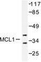 MCL1 Apoptosis Regulator, BCL2 Family Member antibody, LS-C176111, Lifespan Biosciences, Western Blot image 