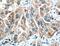 Hypoxia Inducible Factor 1 Subunit Alpha Inhibitor antibody, 10646-1-AP, Proteintech Group, Immunohistochemistry paraffin image 
