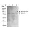 Potassium Voltage-Gated Channel Subfamily C Member 2 antibody, MA5-27683, Invitrogen Antibodies, Western Blot image 