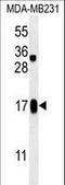 Small Integral Membrane Protein 14 antibody, LS-C168142, Lifespan Biosciences, Western Blot image 