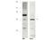 HUS1 Checkpoint Clamp Component B antibody, A13393, Boster Biological Technology, Western Blot image 