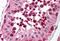 Uracil-DNA glycosylase antibody, MBS240300, MyBioSource, Immunohistochemistry paraffin image 