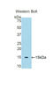 Serpin Family A Member 6 antibody, LS-C294099, Lifespan Biosciences, Western Blot image 