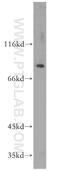 Suppression Of Tumorigenicity 5 antibody, 12893-1-AP, Proteintech Group, Western Blot image 