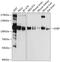 Oxysterol-binding protein 1 antibody, 19-241, ProSci, Western Blot image 