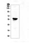 Cytochrome P450 Family 19 Subfamily A Member 1 antibody, A00071, Boster Biological Technology, Western Blot image 