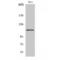 Nuclear Factor Of Activated T Cells 3 antibody, LS-C384850, Lifespan Biosciences, Western Blot image 