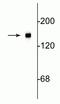 Neurofilament Medium antibody, A06821-1, Boster Biological Technology, Western Blot image 