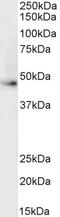 Vacuolar Protein Sorting 45 Homolog antibody, 46-588, ProSci, Western Blot image 