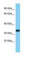 Transmembrane protein 236 antibody, orb327168, Biorbyt, Western Blot image 