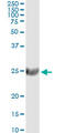 ST6 Beta-Galactoside Alpha-2,6-Sialyltransferase 1 antibody, LS-C198196, Lifespan Biosciences, Immunoprecipitation image 