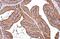 Aldehyde Dehydrogenase 1 Family Member A3 antibody, NBP2-15339, Novus Biologicals, Immunohistochemistry paraffin image 