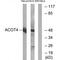 Acyl-CoA Thioesterase 4 antibody, PA5-49969, Invitrogen Antibodies, Western Blot image 