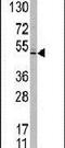 Taspase 1 antibody, PA5-11411, Invitrogen Antibodies, Western Blot image 