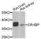Corticotropin Releasing Hormone Binding Protein antibody, LS-B15599, Lifespan Biosciences, Western Blot image 
