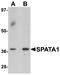 Spermatogenesis Associated 1 antibody, A18198, Boster Biological Technology, Western Blot image 