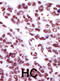 Protein Kinase C Epsilon antibody, abx033117, Abbexa, Immunohistochemistry frozen image 