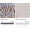 Epithelial Splicing Regulatory Protein 1 antibody, NBP1-82202, Novus Biologicals, Immunohistochemistry paraffin image 