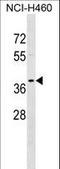 Tropomyosin 2 antibody, LS-C157249, Lifespan Biosciences, Western Blot image 