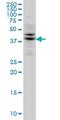 Tribbles Pseudokinase 2 antibody, H00028951-M04, Novus Biologicals, Western Blot image 