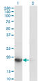 Ubiquitin Conjugating Enzyme E2 G1 antibody, LS-C198396, Lifespan Biosciences, Western Blot image 