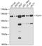 Naalad1 antibody, 18-999, ProSci, Western Blot image 