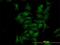 Cyclin Dependent Kinase 4 antibody, H00001019-M03, Novus Biologicals, Immunocytochemistry image 