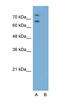 RAR Related Orphan Receptor A antibody, orb330425, Biorbyt, Western Blot image 