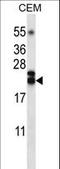 TNF Superfamily Member 4 antibody, LS-B10542, Lifespan Biosciences, Western Blot image 