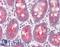 NAD(P)H Quinone Dehydrogenase 1 antibody, LS-B8354, Lifespan Biosciences, Immunohistochemistry frozen image 