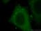 Interleukin 20 Receptor Subunit Beta antibody, 20521-1-AP, Proteintech Group, Immunofluorescence image 