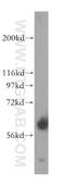 Flavin Containing Dimethylaniline Monoxygenase 5 antibody, 13699-1-AP, Proteintech Group, Western Blot image 