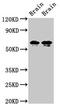 Syntaxin Binding Protein 1 antibody, CSB-PA022905LA01HU, Cusabio, Western Blot image 