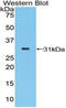 STAM Binding Protein antibody, MBS2004380, MyBioSource, Western Blot image 