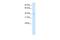 Diencephalon/Mesencephalon Homeobox 1 antibody, A10724, Boster Biological Technology, Western Blot image 