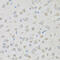 Proenkephalin-A antibody, 22-112, ProSci, Immunohistochemistry paraffin image 