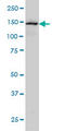 Symplekin antibody, LS-B6171, Lifespan Biosciences, Western Blot image 