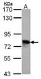 Transforming Growth Factor Beta Induced antibody, NBP2-20613, Novus Biologicals, Western Blot image 