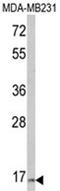 Thyrotropin subunit beta antibody, AP18229PU-N, Origene, Western Blot image 