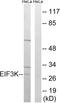 Eukaryotic Translation Initiation Factor 3 Subunit K antibody, LS-C119966, Lifespan Biosciences, Western Blot image 