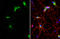 Collagen Type VI Alpha 1 Chain antibody, GTX109963, GeneTex, Immunocytochemistry image 