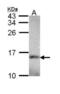 NADH:Ubiquinone Oxidoreductase Subunit A5 antibody, NBP1-33504, Novus Biologicals, Western Blot image 