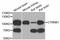Catenin Beta 1 antibody, STJ113088, St John