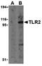 Toll Like Receptor 2 antibody, PA5-20020, Invitrogen Antibodies, Western Blot image 
