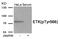 BMX Non-Receptor Tyrosine Kinase antibody, AP55905PU-N, Origene, Western Blot image 