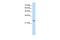 Troponin I1, Slow Skeletal Type antibody, PA5-42108, Invitrogen Antibodies, Western Blot image 