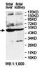 FAH antibody, orb78396, Biorbyt, Western Blot image 