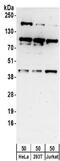 MAPK Activated Protein Kinase 3 antibody, NBP2-32092, Novus Biologicals, Western Blot image 