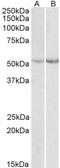 Phenylalanine Hydroxylase antibody, LS-B9223, Lifespan Biosciences, Western Blot image 