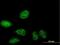 SERTA Domain Containing 2 antibody, H00009792-B01P, Novus Biologicals, Immunocytochemistry image 